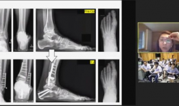 骨科视频,常见骨折与手术技巧全解析